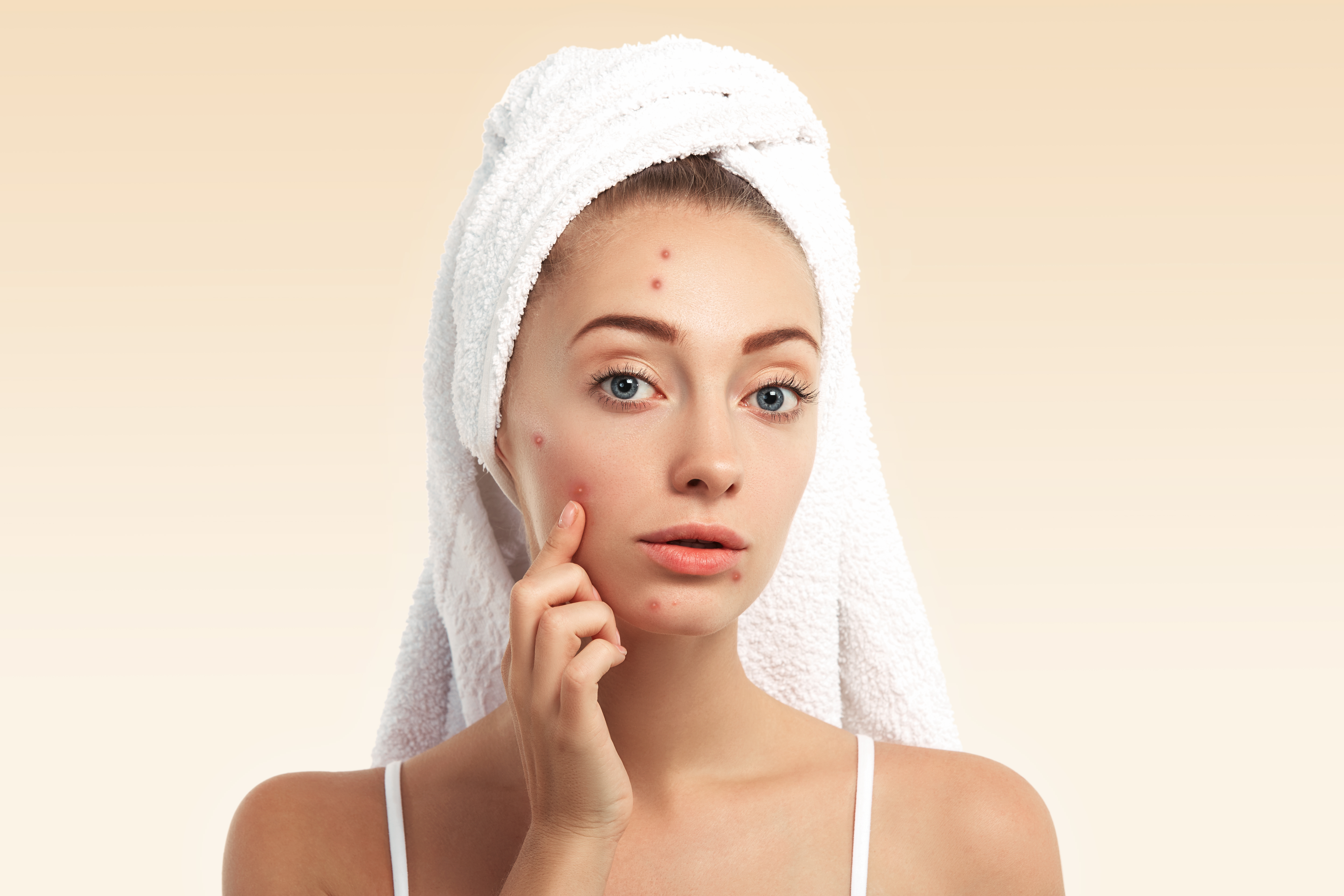 De beste skincare routine voor acne: simpel stappenplan voor ochtend en avond